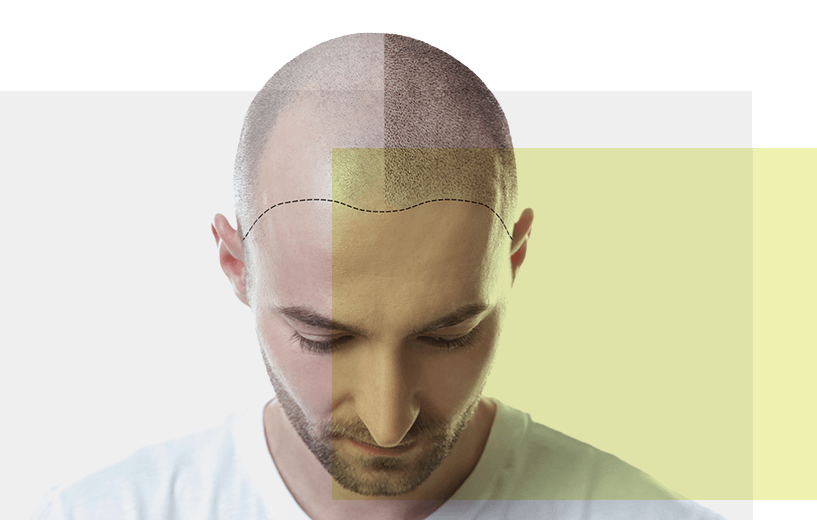 homme de face baissant sa tête rasée
