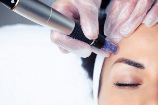 amir-medecine-esthetique-com-formation-microneedling