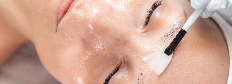 amir-medecine-esthetique-blog-peeling-visage